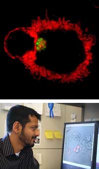 The green fluorescent-labeled HIV is being processed by two cells of the immune system (top). Kedar uses special software programs to analyze images captured by a microscope (bottom).
